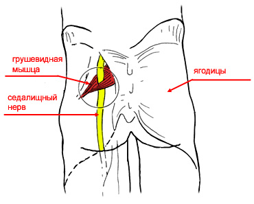 raspolozhenie-sedalishnogo-nerva